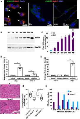 Pannexin 1 Regulates Skeletal Muscle Regeneration by Promoting Bleb-Based Myoblast Migration and Fusion Through a Novel Lipid Based Signaling Mechanism